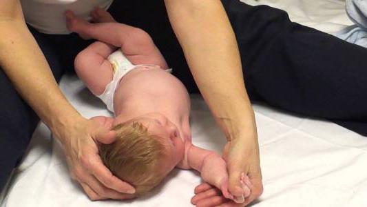 массаж при кривошее новорожденного