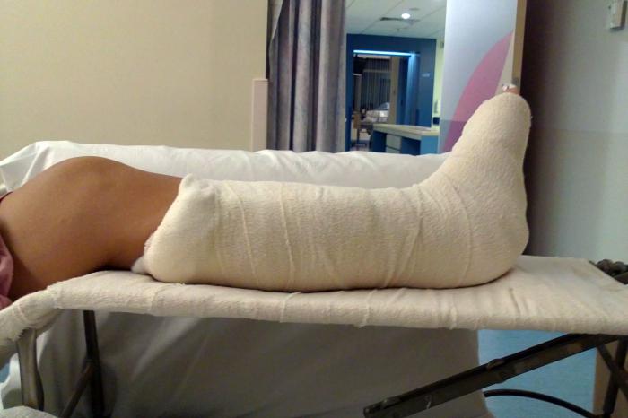Как врачи лечат перелом ноги thumbnail
