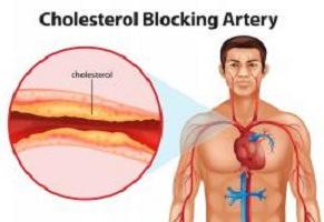 уровень холестерина в крови 