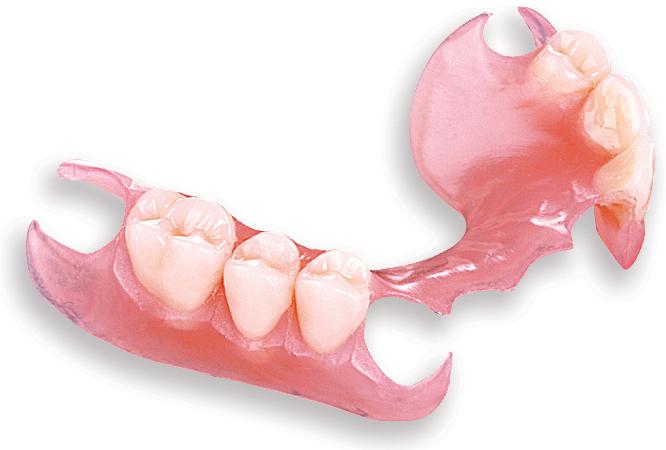 покрывные зубные протезы съемные