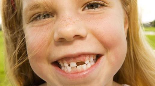 какие зубы меняются у детей схема