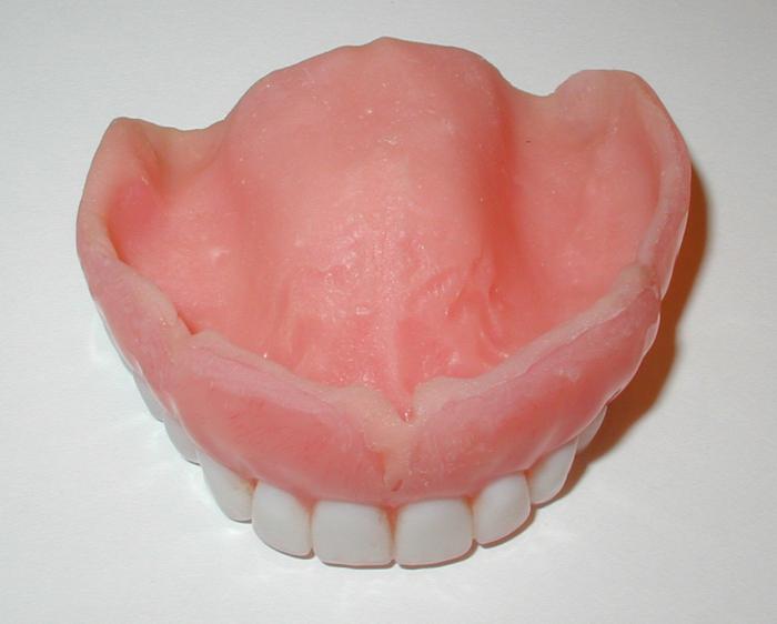 верхние зубные протезы
