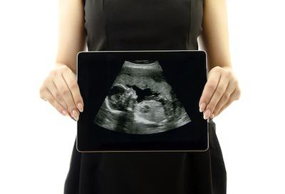 УЗИ: узнать срок беременности