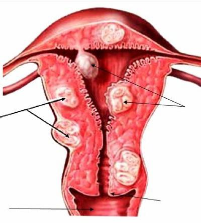 менструация после родов