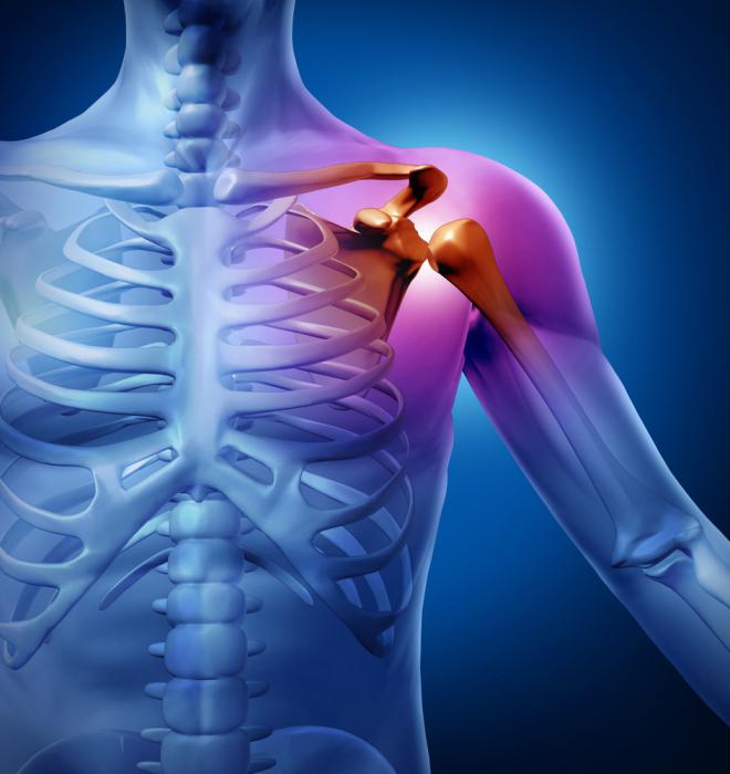остеоартроз плечевого сустава