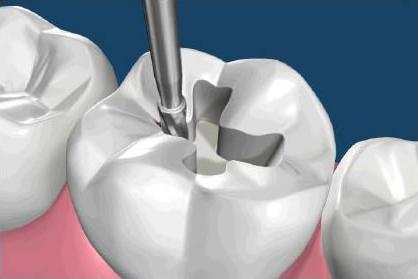 Почему после лечения зуба болят другие зубы thumbnail