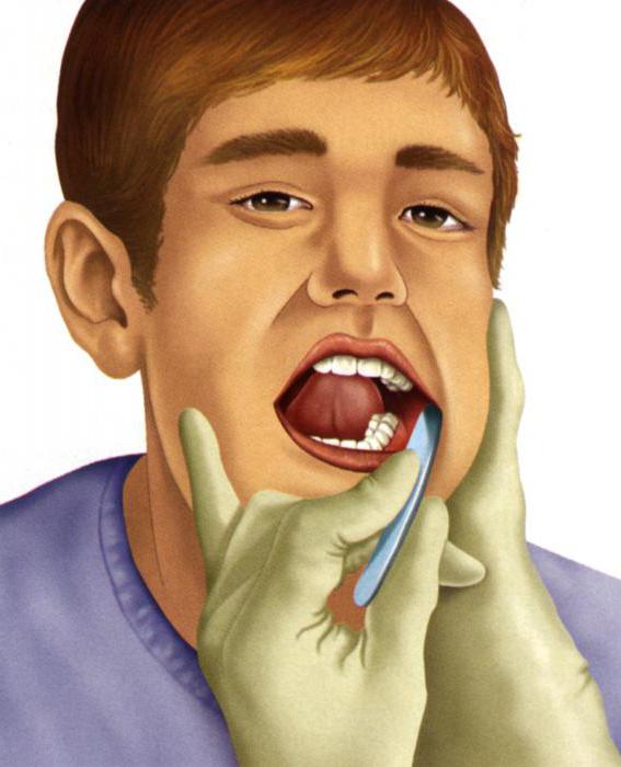 Полоскание рта пациента