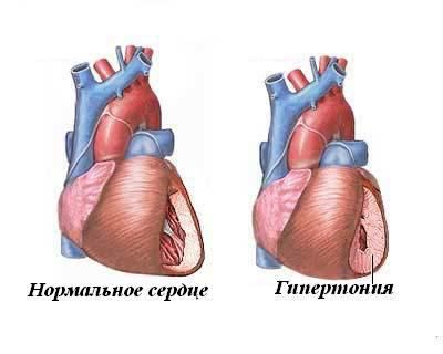 таблетки ад норма