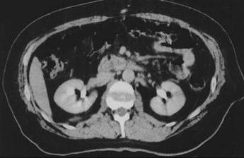 Анатомия внутренние органы поджелудочная железа thumbnail