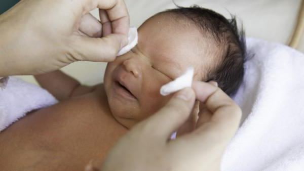 конъюнктивит у новорожденных лечение в домашних условиях