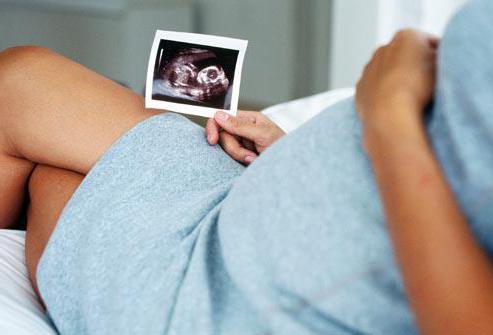 почему беременным нельзя сидеть нога на ногу