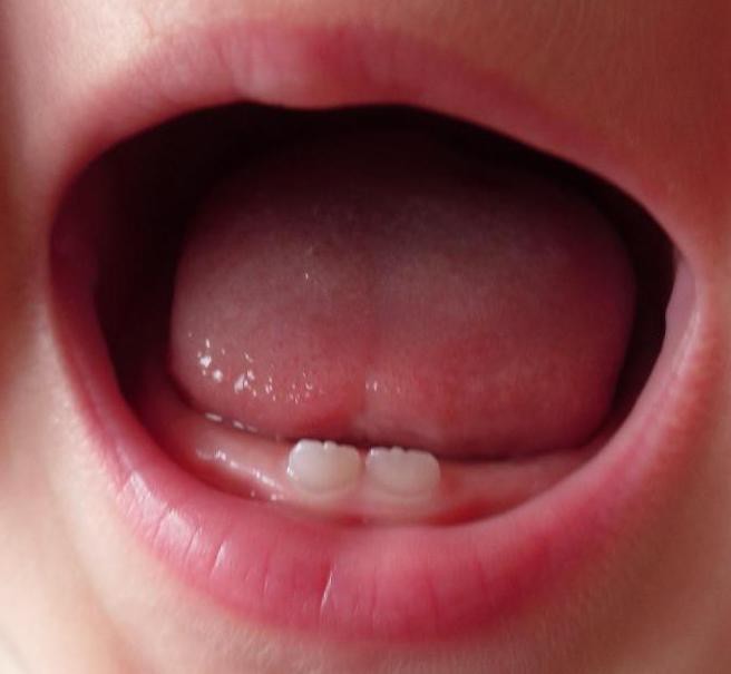 сколько молочных зубов у детей в 3 года