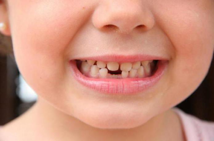 сколько бывает молочных зубов у детей