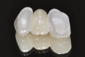 циркониевые коронки для зубов отзывы