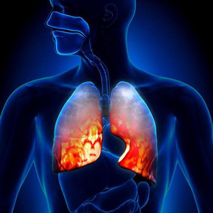 12 ноября всемирный день борьбы с пневмонией