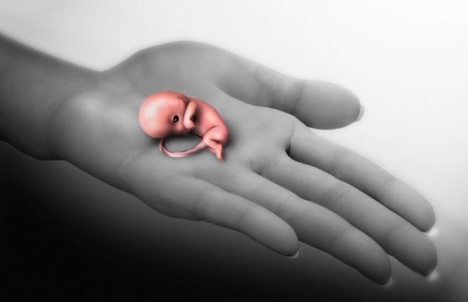 запрет абортов