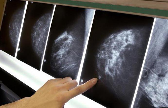 маммография цена