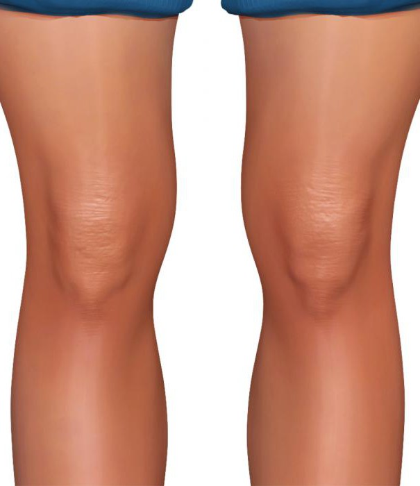 коленный сустав анатомия фото