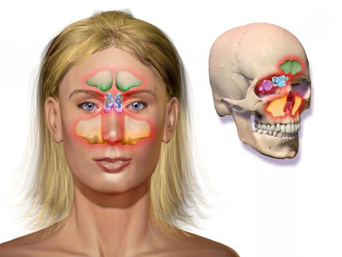 компьютерная томография придаточных пазух носа