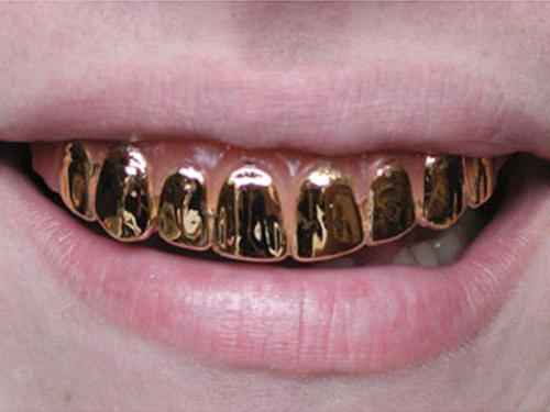 золотые зубы описание 