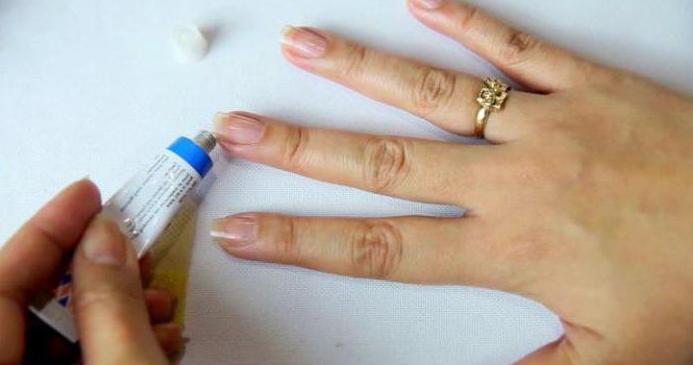 Трескается кожа на пальцах рук около ногтей лечение