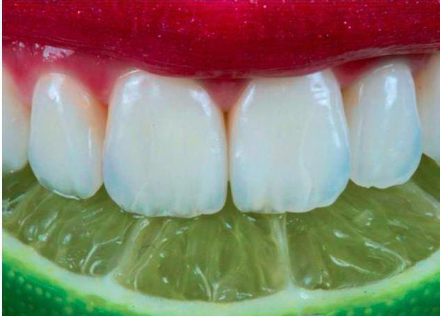 Чувствительность зубов: как снять (зубная паста)