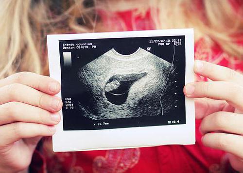 Эмбрион на 3 4 неделе беременности thumbnail