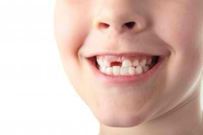 сроки выпадения молочных зубов у детей 