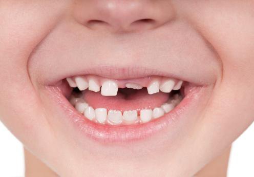 молочные зубы у детей схема выпадения фото 