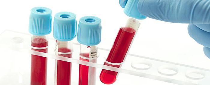 анализ крови на РМП сколько делается