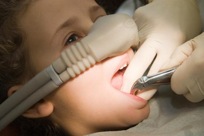  седация в стоматологии