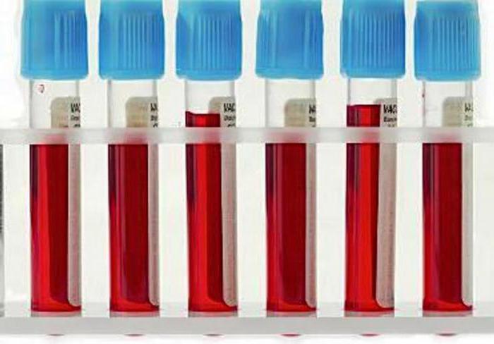лейкоцитарная формула крови расшифровка