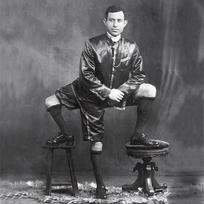 3 нога где. Франческо Лентини, человек с тремя ногами (фото)