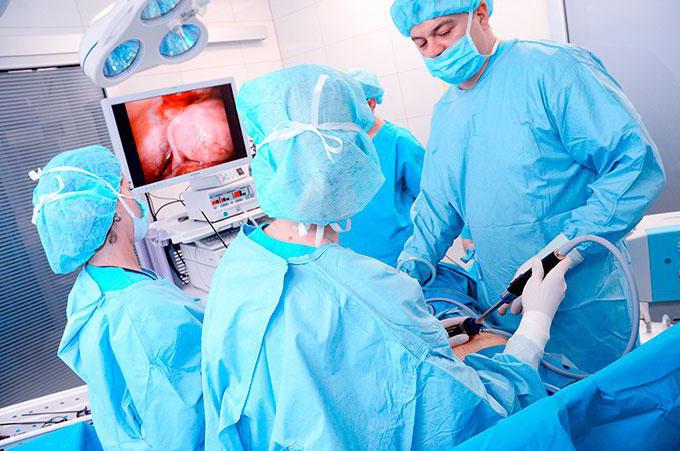 Удаление матки лапароскопическим методом, подготовка к операции и восстановление