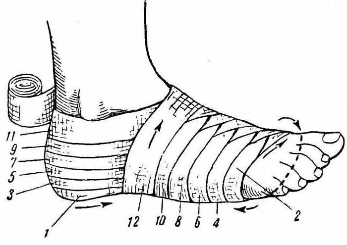 Изображение - Наложение черепашьей повязки на коленный сустав 1951940
