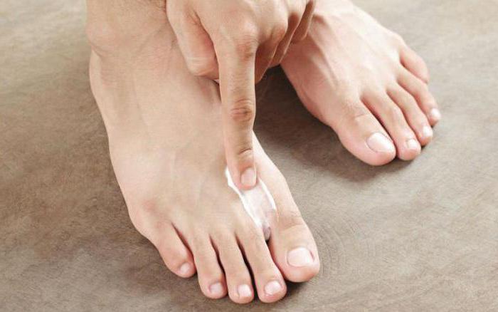 как избавиться от грибка ногтей на ногах
