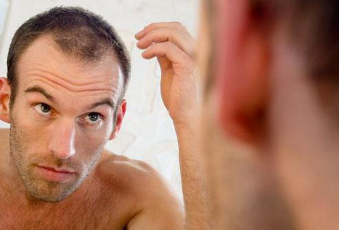 почему лысеют мужчины 