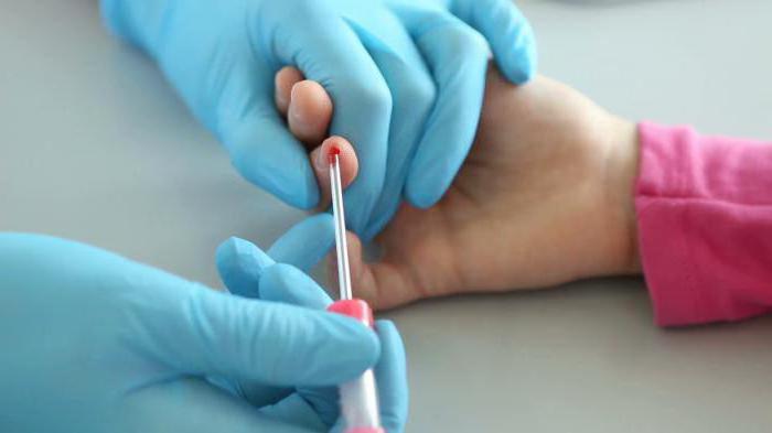 Все виды анализов крови из пальца thumbnail