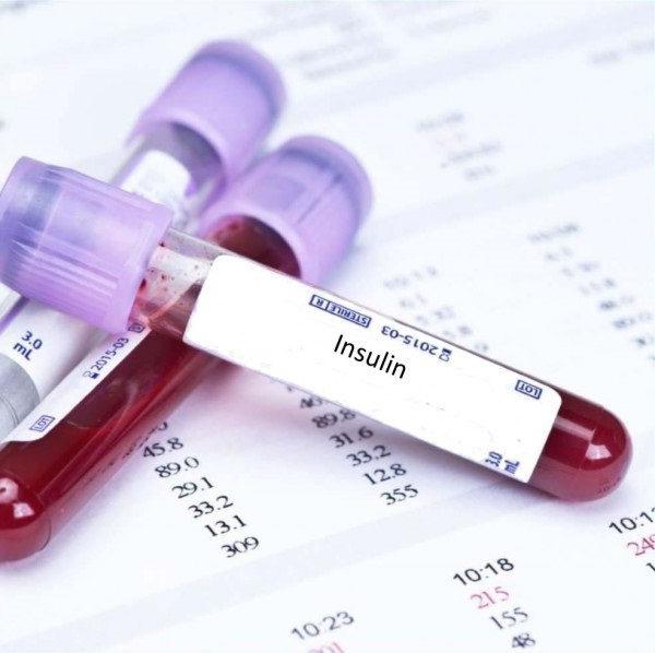 Какой анализ крови показывает инсулин thumbnail