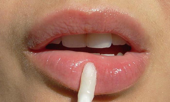 почему трескаются уголки губ и как лечить