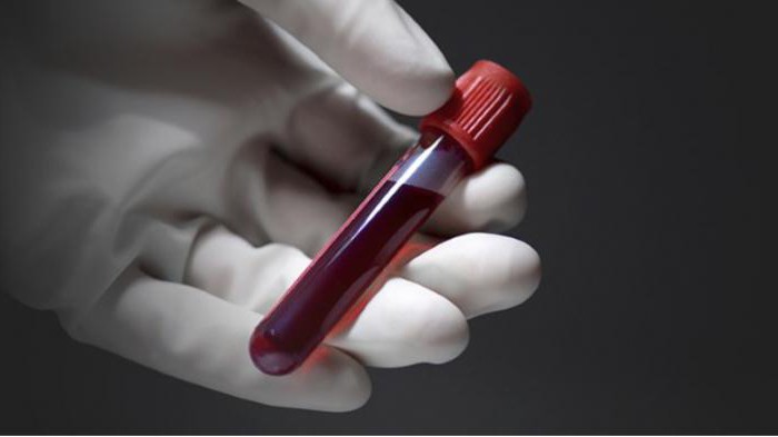 Rdv анализ крови повышен что это значит thumbnail