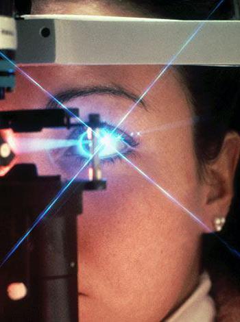 Применение лазера в офтальмологии.