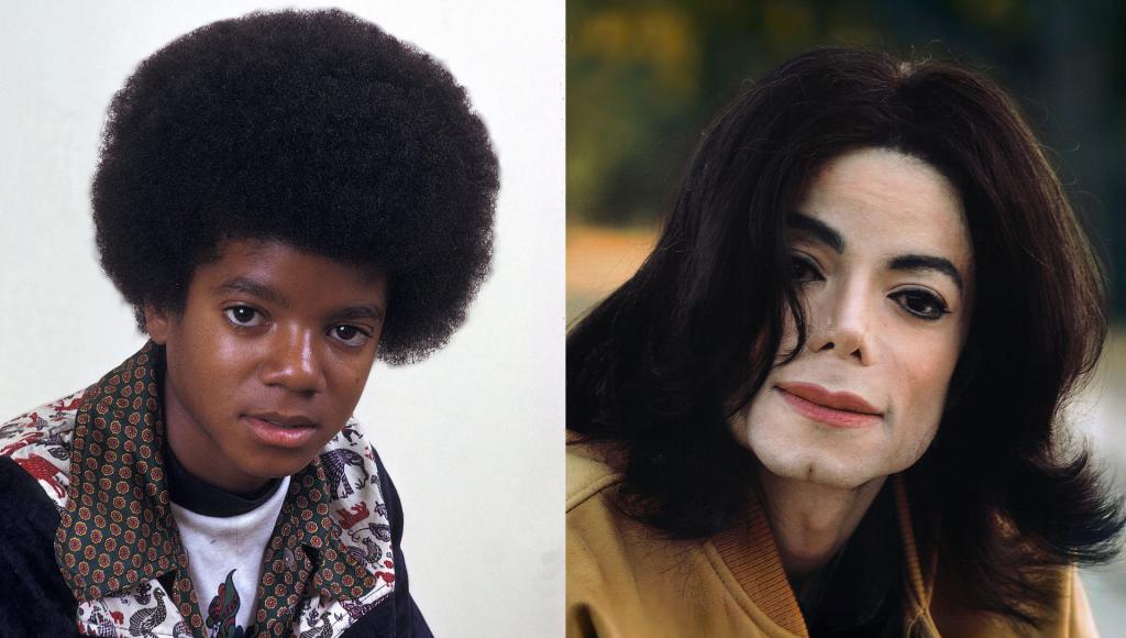 Майкл Джексон: до и после