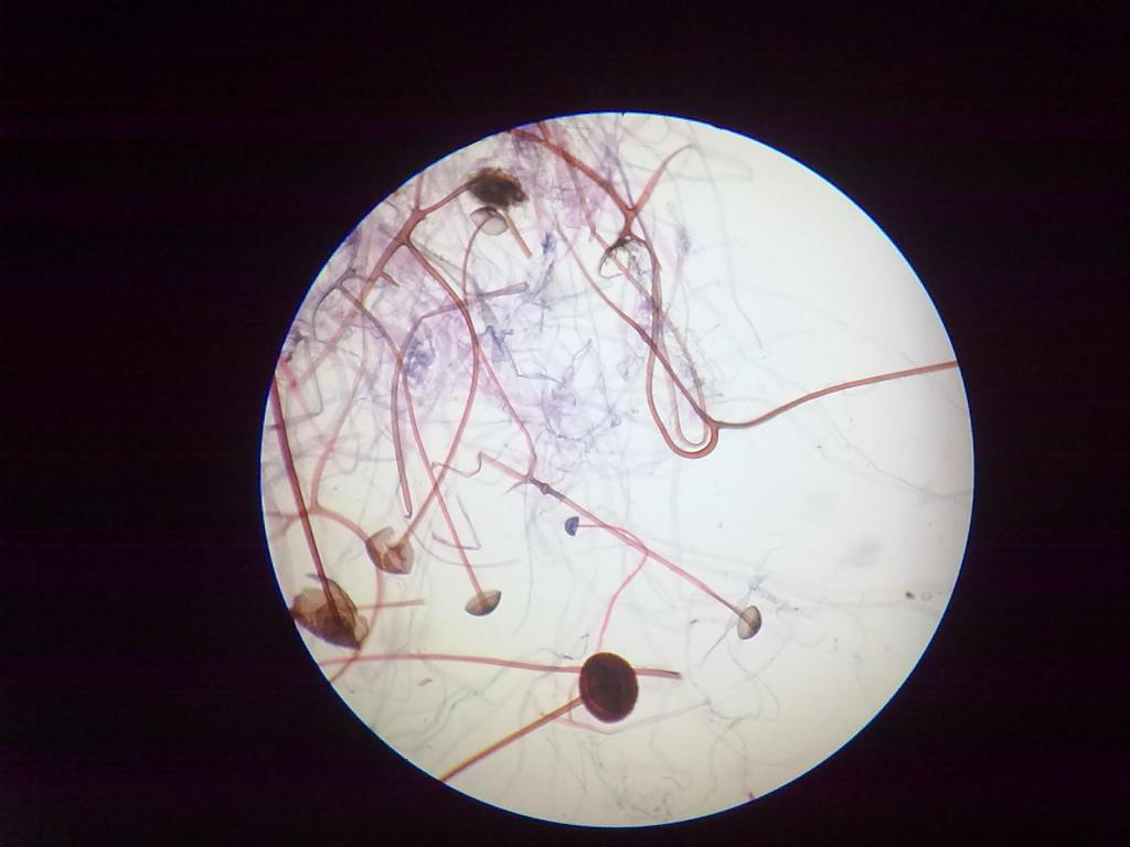 гифы мукора под микроскопом