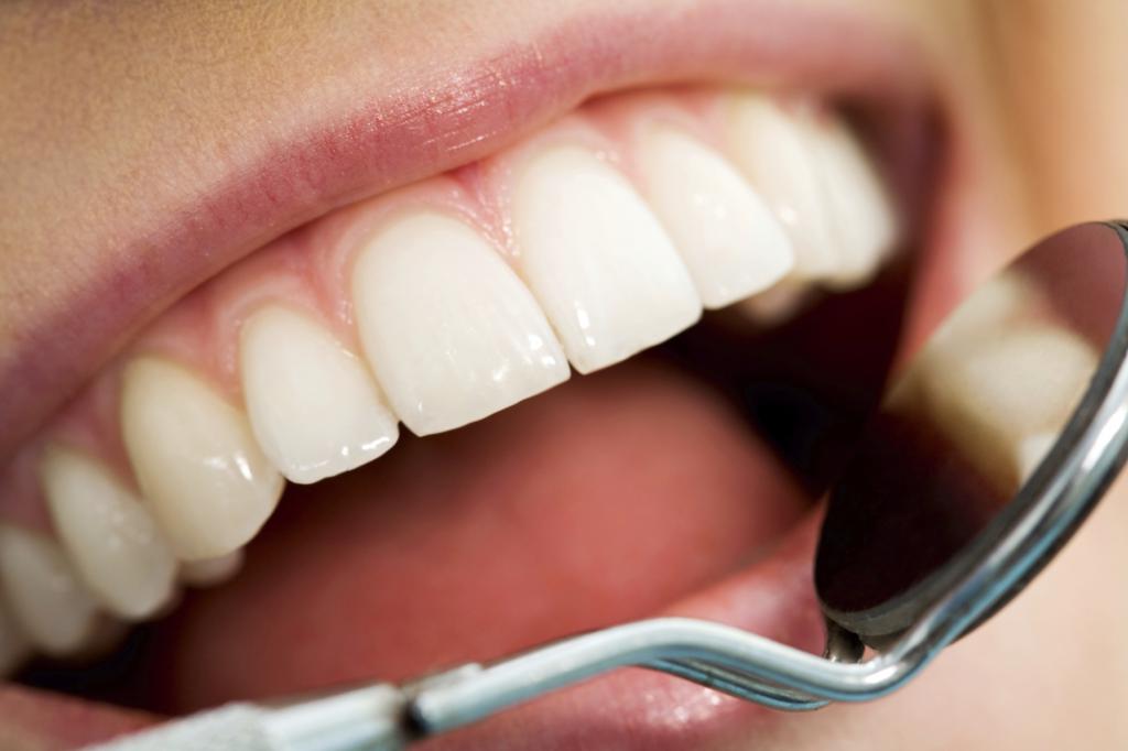 причины образования зубного налета