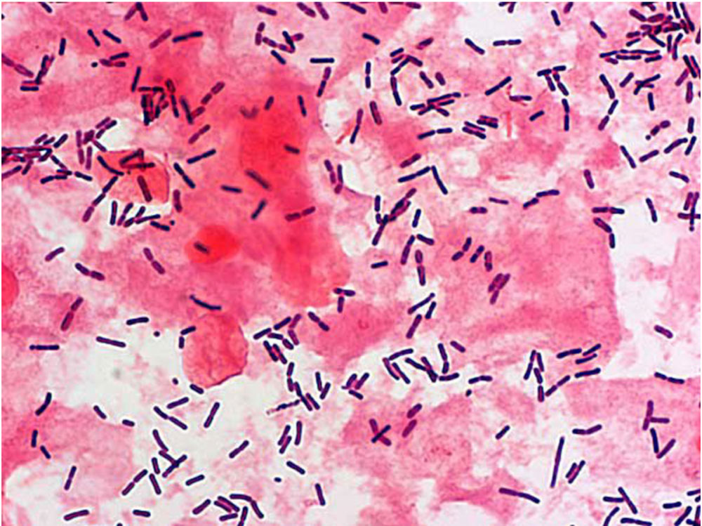 Нормофлора lactobacillus spp