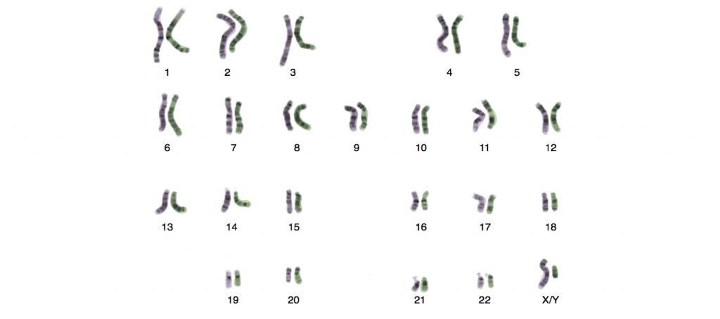 Человеческий набор хромосом