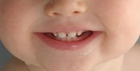 зубы у детей
