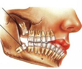 что делать когда болит зуб