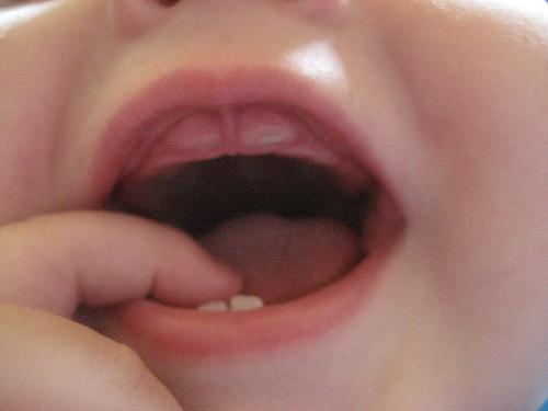 во сколько месяцев режутся первые зубки